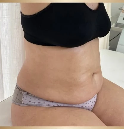 Biomē Ice transformação depois